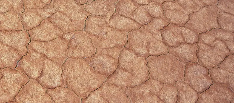 5 posibles causas de la piel seca y escamosa